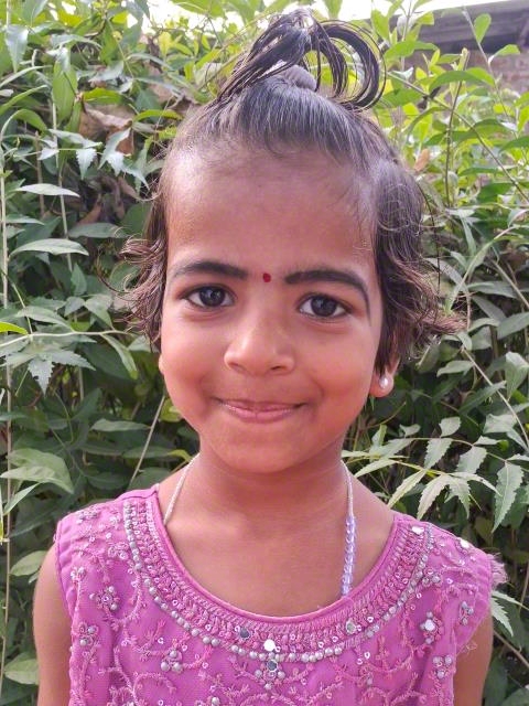 World Vision India